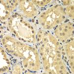 SMAD2/SMAD3 Antibody in Immunohistochemistry (Paraffin) (IHC (P))