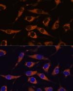 SMAP1 Polyclonal Antibody