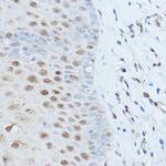 SMARCD2 Polyclonal Antibody