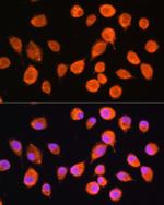 SMPD4 Polyclonal Antibody