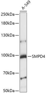 SMPD4 Antibody in Western Blot (WB)