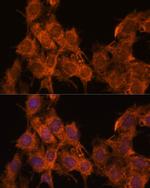 SNX15 Antibody in Immunocytochemistry (ICC/IF)