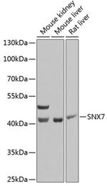 SNX7 Polyclonal Antibody