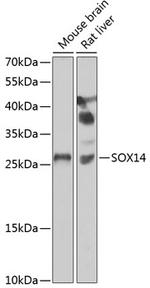 SOX14 Antibody in Western Blot (WB)