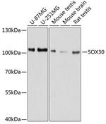 SOX30 Polyclonal Antibody