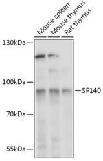 SP140 Polyclonal Antibody