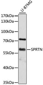 SPRTN Polyclonal Antibody