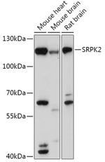 SRPK2 Polyclonal Antibody
