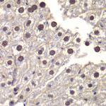 ST14 Antibody in Immunohistochemistry (Paraffin) (IHC (P))
