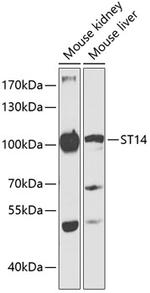 ST14 Antibody in Western Blot (WB)