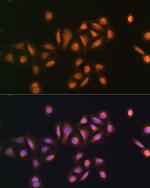 STK38 Antibody in Immunocytochemistry (ICC/IF)