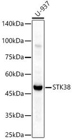 STK38 Antibody in Western Blot (WB)