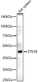 STK38 Antibody in Western Blot (WB)