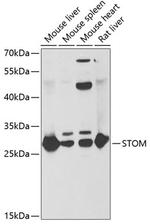 STOM Polyclonal Antibody