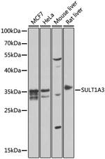 SULT1A3 Polyclonal Antibody
