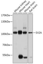 SV2A Antibody in Western Blot (WB)