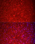 NKB Polyclonal Antibody