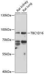 TBC1D16 Polyclonal Antibody