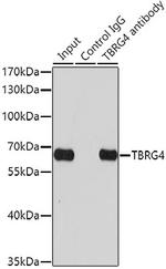 TBRG4 Antibody in Immunoprecipitation (IP)