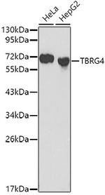 TBRG4 Antibody in Western Blot (WB)
