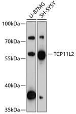 TCP11L2 Polyclonal Antibody