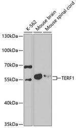 TERF1 Antibody in Western Blot (WB)