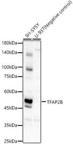 TFAP2B Polyclonal Antibody