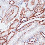 TFRC Antibody in Immunohistochemistry (Paraffin) (IHC (P))