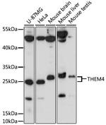 THEM4 Polyclonal Antibody