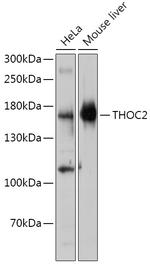 THOC2 Polyclonal Antibody