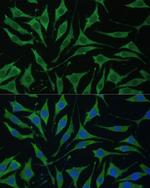 TIMM8B Antibody in Immunocytochemistry (ICC/IF)