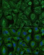 TIMM8B Polyclonal Antibody