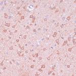 TIMM8B Antibody in Immunohistochemistry (Paraffin) (IHC (P))