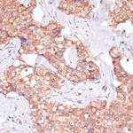 TIMM8B Antibody in Immunohistochemistry (Paraffin) (IHC (P))