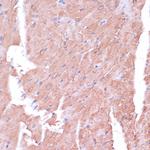 TIMM8B Antibody in Immunohistochemistry (Paraffin) (IHC (P))