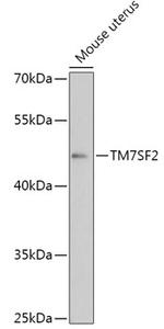 TM7SF2 Polyclonal Antibody