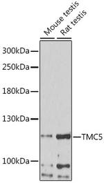 TMC5 Antibody in Western Blot (WB)