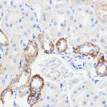 TMED3 Antibody in Immunohistochemistry (Paraffin) (IHC (P))