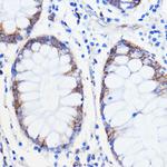 TMED3 Antibody in Immunohistochemistry (Paraffin) (IHC (P))