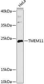 TMEM11 Antibody in Western Blot (WB)