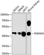 TMEM43 Polyclonal Antibody
