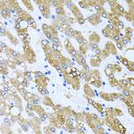 TOB2 Polyclonal Antibody