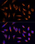 TOM20 Antibody in Immunocytochemistry (ICC/IF)