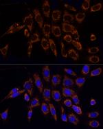 TOM20 Antibody in Immunocytochemistry (ICC/IF)
