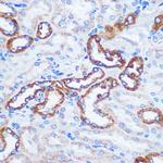 TOM20 Antibody in Immunohistochemistry (Paraffin) (IHC (P))