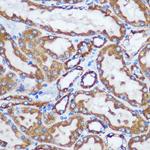 TOM20 Antibody in Immunohistochemistry (Paraffin) (IHC (P))