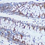 TOM20 Antibody in Immunohistochemistry (Paraffin) (IHC (P))