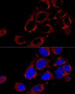 TOMM40 Polyclonal Antibody