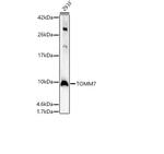 TOMM7 Polyclonal Antibody