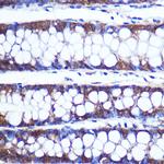 TOP1MT Polyclonal Antibody
